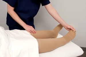 Lower Limb Swelling and Lupus
