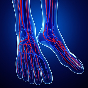 Symptoms of Chronic Venous Insufficiency