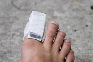 Proper Treatment of Broken Toes