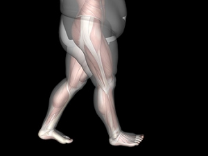 Can My Child Have Foot Conditions as a Result of Being Overweight?
