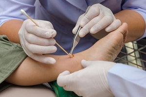 Caring for Wounds on the Feet