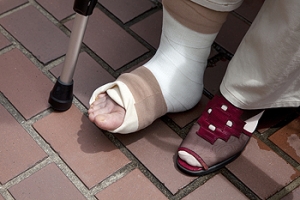 Have I Broken My Ankle?
