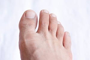 Possible Causes of Neuropathy