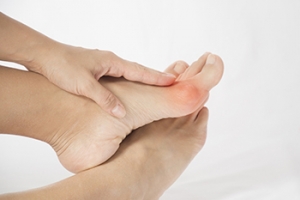 Should I Get Bunion Surgery?