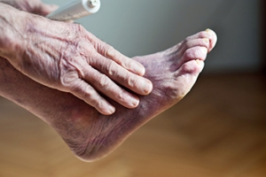 What Is Raynaud’s Phenomenon?