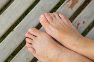 The Basics of Ingrown Toenails